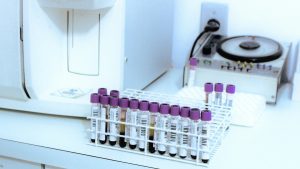 Νόσος του Crohn: Μια απλή εξέταση αίματος μπορεί να την προβλέψει χρόνια πριν από την εμφάνιση των συμπτωμάτων