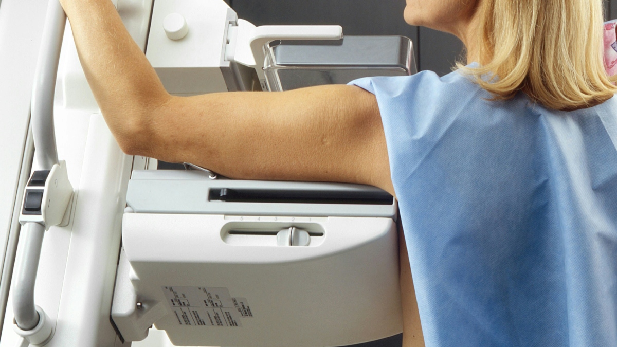 Καρκίνος του μαστού: Η τεχνητή νοημοσύνη βελτιώνει τον προληπτικό έλεγχο