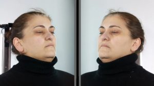 Αττική: Δημοσιοποιήθηκαν τα στοιχεία της 45χρονης που παρίστανε την οικιακή βοηθό και έκλεβε ΑμεΑ