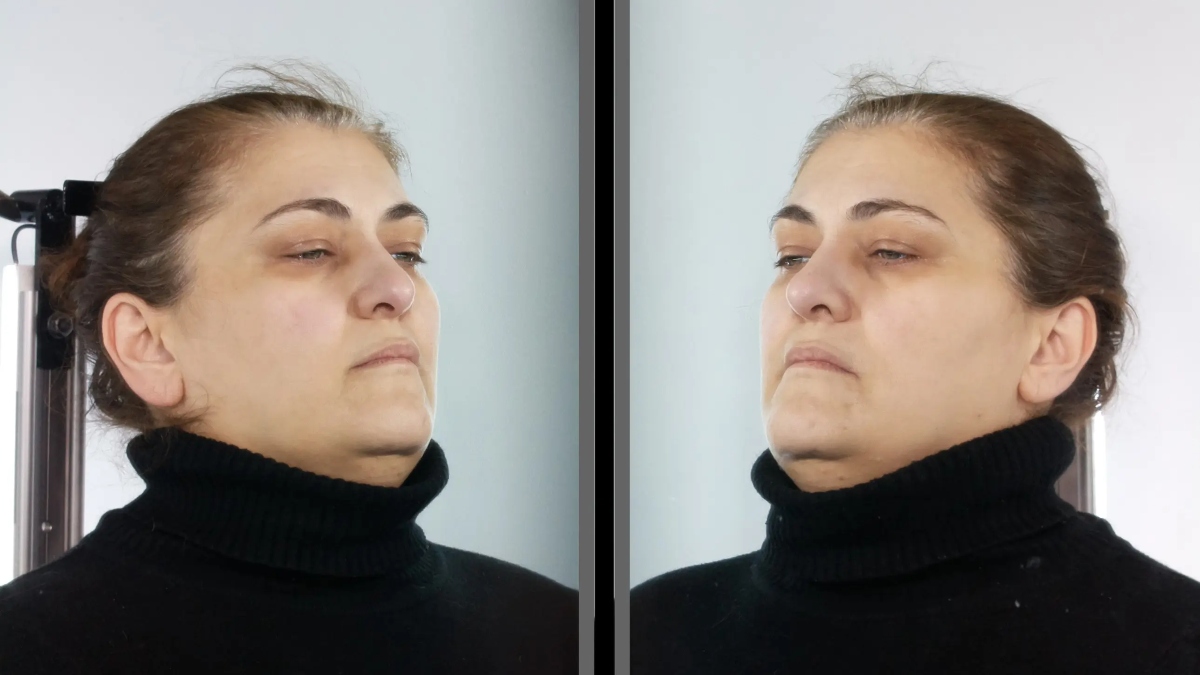 Αττική: Δημοσιοποιήθηκαν τα στοιχεία της 45χρονης που παρίστανε την οικιακή βοηθό και έκλεβε ΑμεΑ