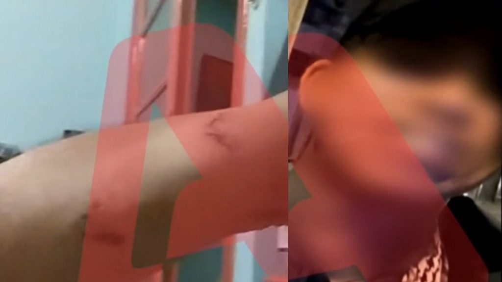 Σοκαριστικό περιστατικό στην Ομόνοια – Νεαρός έβαλε το πίτμπουλ του να επιτεθεί σε 30χρονο για να τον ληστέψει