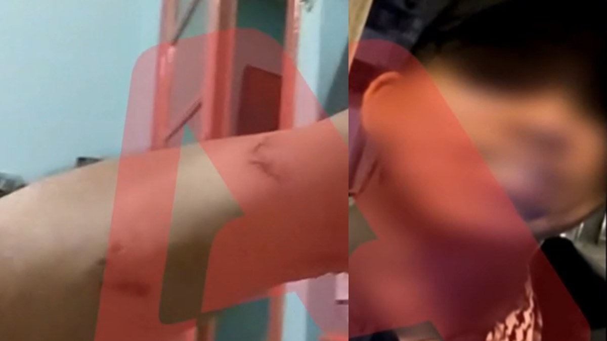 Σοκαριστικό περιστατικό στην Ομόνοια – Νεαρός έβαλε το πίτμπουλ του να επιτεθεί σε 30χρονο για να τον ληστέψει