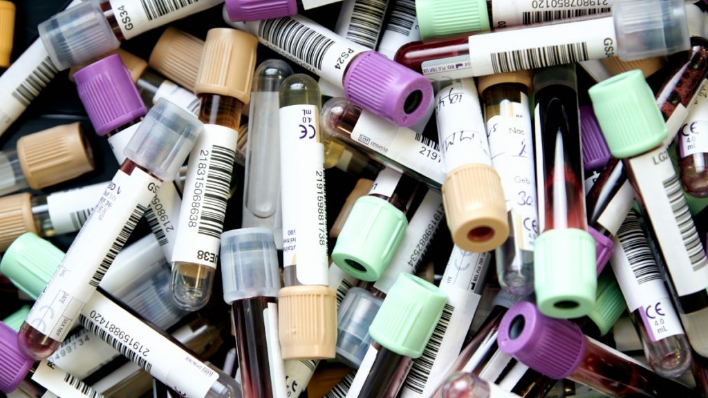 Σοβαρές ελλείψεις αίματος απειλούν εκατοντάδεςε ασθενείς με Θαλασσαιμία