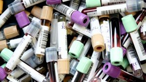 Σοβαρές ελλείψεις αίματος απειλούν εκατοντάδες ασθενείς με Θαλασσαιμία