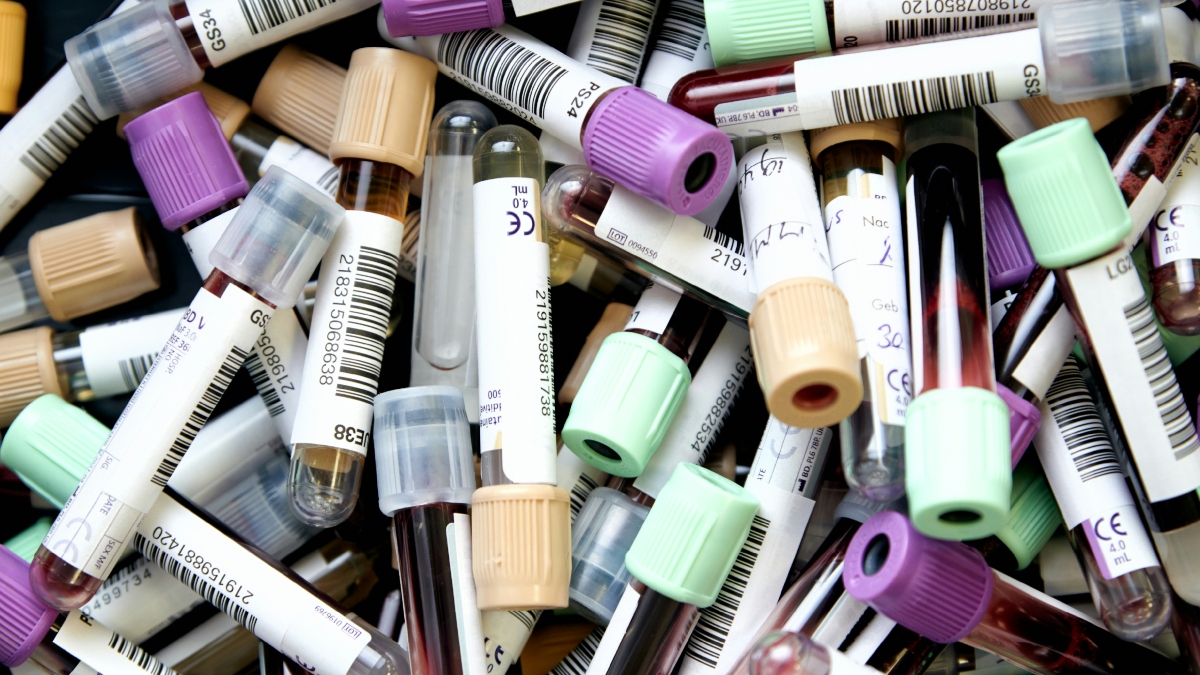 Σοβαρές ελλείψεις αίματος απειλούν εκατοντάδες ασθενείς με Θαλασσαιμία