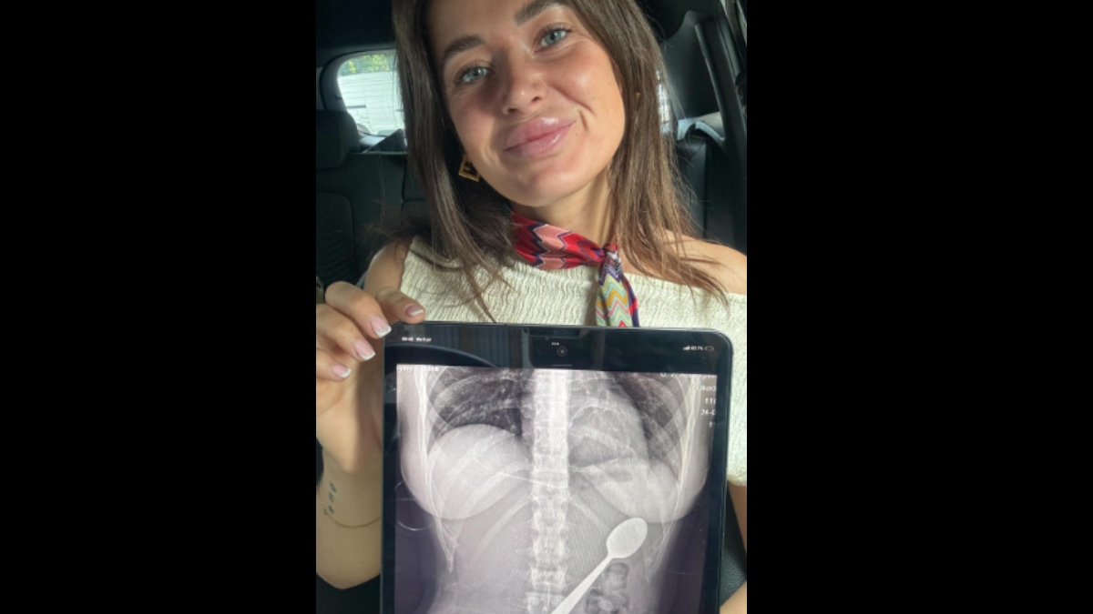 Βέλγιο: 28χρονη κατάπιε κουτάλι 17 εκατοστών όταν πήδηξε πάνω της ο σκύλος της (Βίντεο)