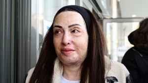 Η συγκινητική ανάρτηση της Ιωάννας Παλιοσπύρου από τις θεραπείες – “Με ρωτάς πώς αντέχω… δεν ξέρω” (φωτογραφίες)