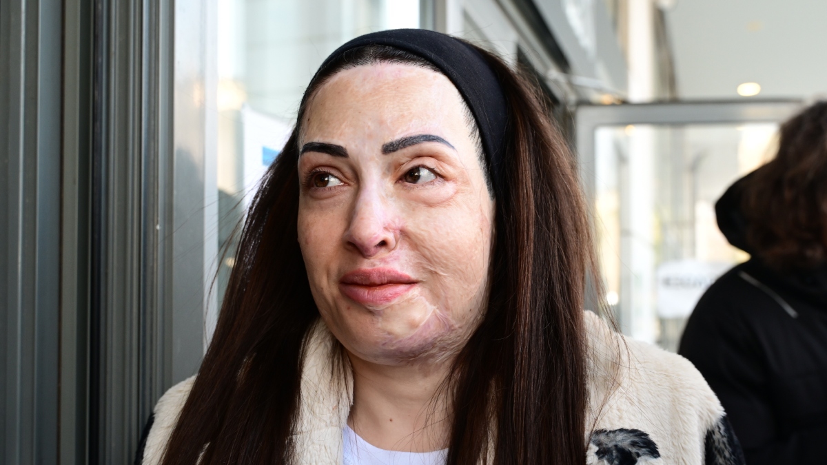 Η συγκινητική ανάρτηση της Ιωάννας Παλιοσπύρου από τις θεραπείες – “Με ρωτάς πώς αντέχω… δεν ξέρω” (φωτογραφίες)