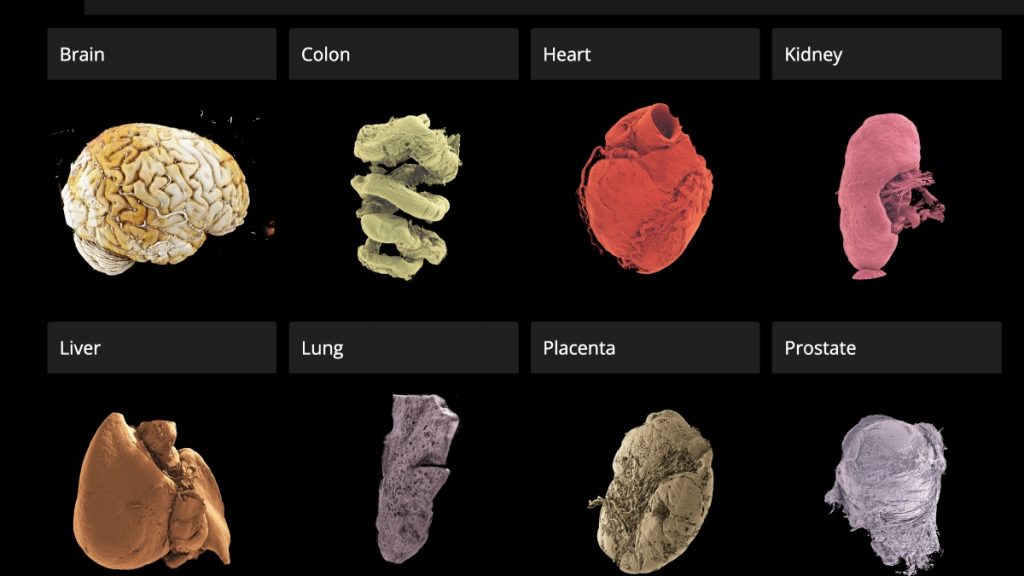 Άτλαντας οργάνων του ανθρώπινου σώματος διαθέσιμος στο διαδίκτυο