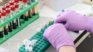 1,4 δισεκατομμύρια άτομα παγκοσμίως έχουν υψηλά επίπεδα λιποπρωτεΐνης Lp(a) – Γιατί είναι σημαντική η εξέταση