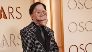 Άνταμ Πέρσον: Συγκλόνισε στο κόκκινο χαλί των Όσκαρ 2026 – Το ηχηρό μήνυμα για τη διαφορετικότητα