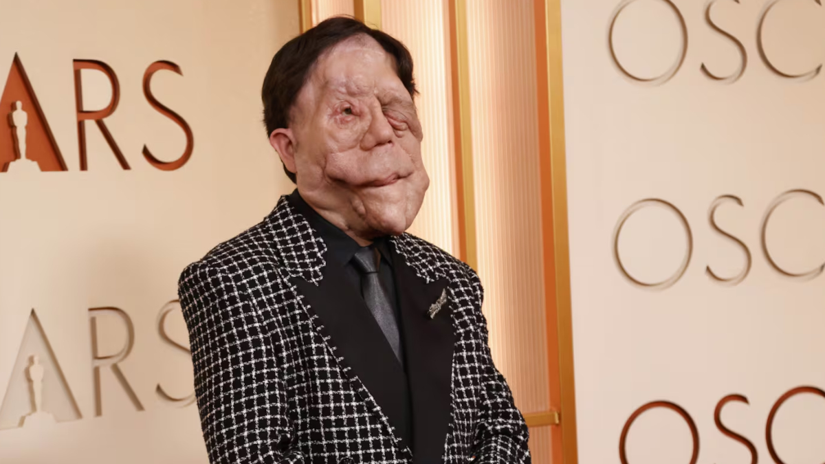 Άνταμ Πέρσον: Συγκλόνισε στο κόκκινο χαλί των Όσκαρ 2026 – Το ηχηρό μήνυμα για τη διαφορετικότητα