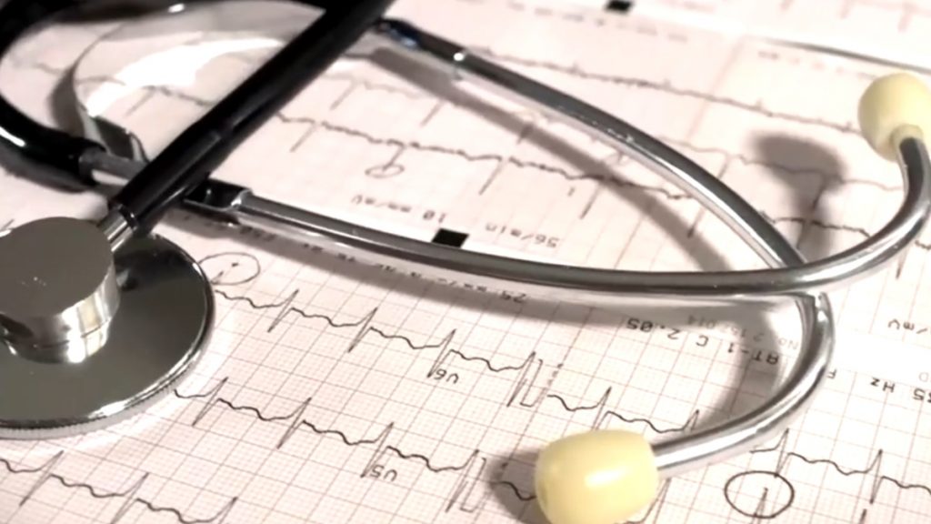 Κολπική μαρμαρυγή: Γιατί αυξάνονται τα ποσοστά στους νέους