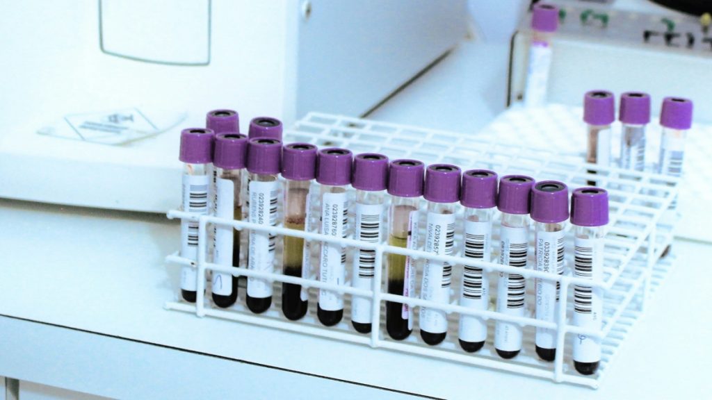 MethylScan: Η απλή εξέταση αίματος που μπορεί να ανιχνεύει ταυτόχρονα καρκίνους και άλλες ασθένειες