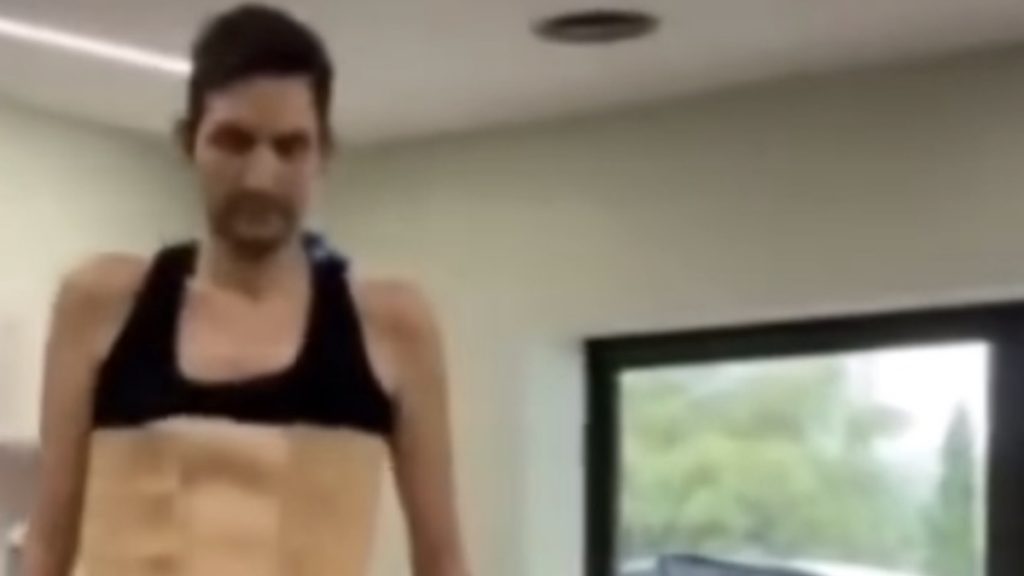 Ήταν σε κώμα και επανήλθε: “Μετά τη ΜΕΘ μαθαίνεις να περπατάς όπως οι αστροναύτες όταν γυρνάνε στη γη” (βίντεο)