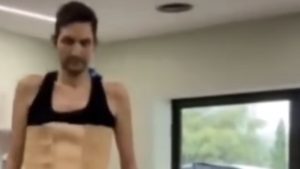 Ήταν σε κώμα και επανήλθε: “Μετά τη ΜΕΘ μαθαίνεις να περπατάς όπως οι αστροναύτες όταν γυρνάνε στη γη” (βίντεο)