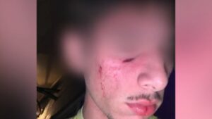 Τρίκαλα: “Θα μου τον σκότωναν, κάποιοι επικροτούσαν τον δράστη” συγκλονίζει η μητέρα του 16χρονου που ξυλοκοπήθηκε άγρια