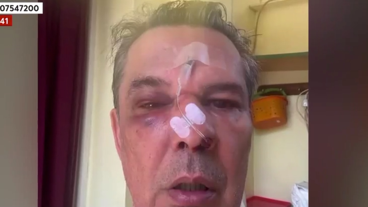 Χαϊδάρι: «Μου ‘χει σπάσει το κόκκαλο στη μύτη» – Όσα αποκάλυψε ο άνδρας που έπεσε θύμα ξυλοδαρμού μέσα σε ιατρείο