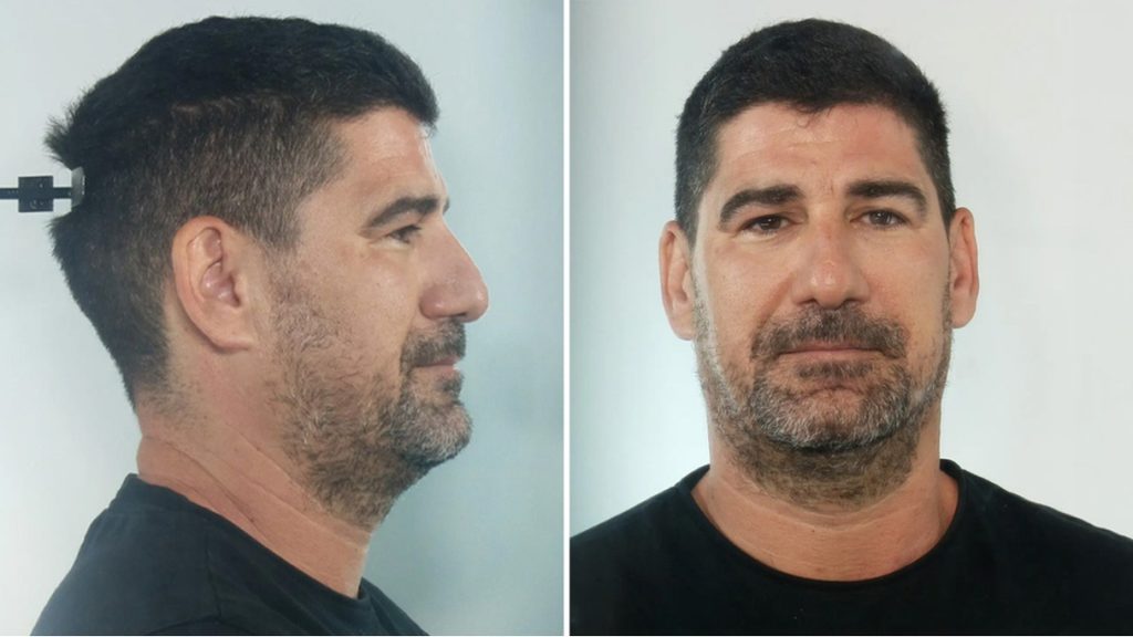 Κεφαλονιά: Στη δημοσιότητα τα στοιχεία του προπονητή που διώκεται για βιασμούς ανήλικων αθλητριών