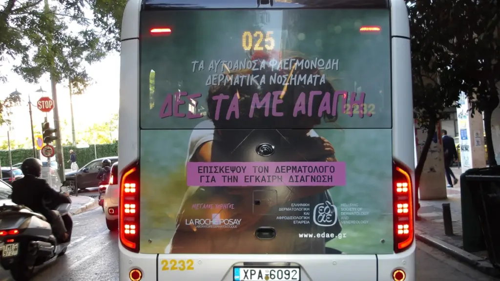 Τα… «αυτοάγνωστα» αυτοάνοσα φλεγμονώδη δερματικά νοσήματα ΔΕΣ ΤΑ ΜΕ ΑΓΑΠΗ
