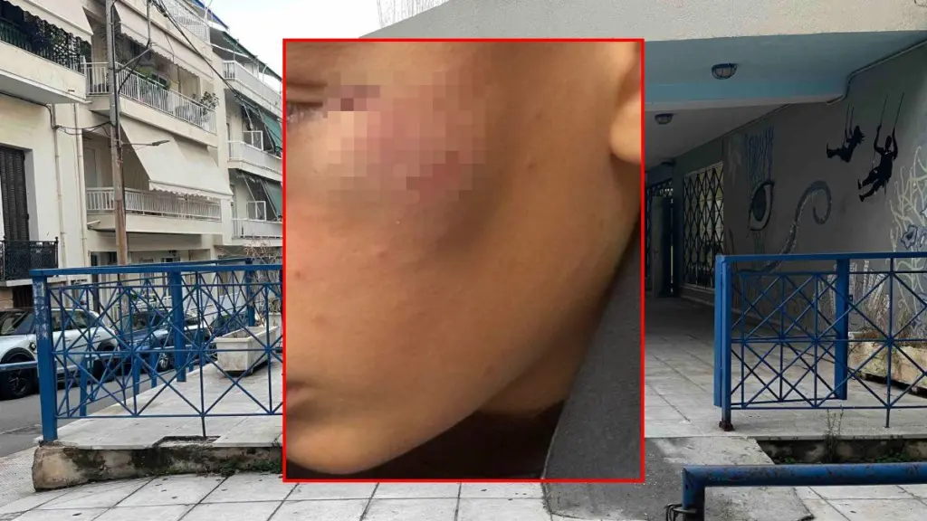 Πειραιάς: 14χρονος ξυλοκοπήθηκε έξω από Γυμνάσιο και λιποθύμησε – «Άλλοι πρέπει να φοβούνται», λέει η μητέρα του στο DEBATER